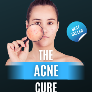 Acne Cure Ebook