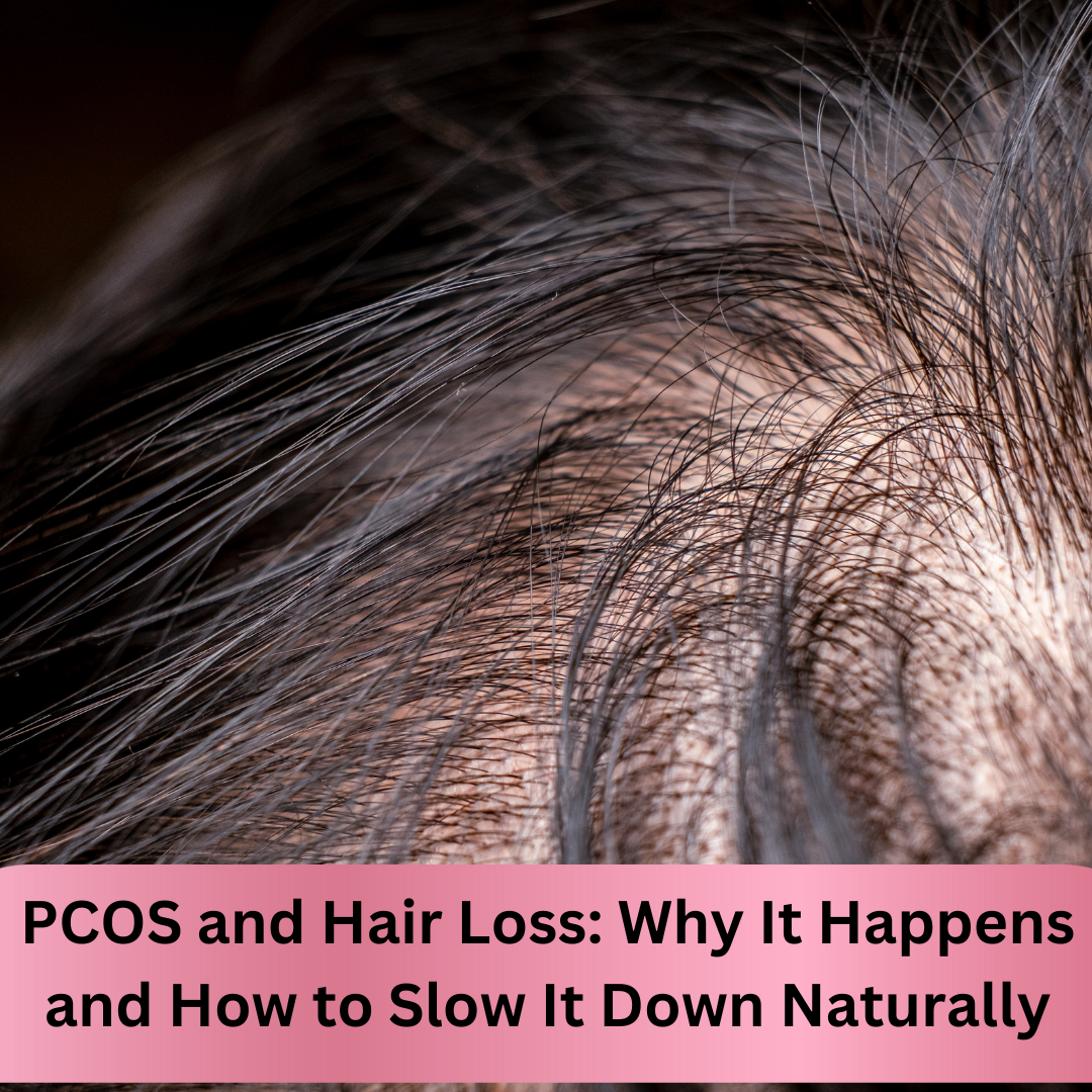 PCOS and Hair Loss