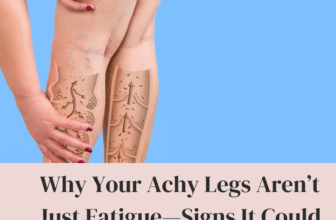 Why Your Achy Legs Aren’t Just Fatigue Signs It Could Be Varicose Veins