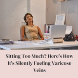 Sitting Too Much? Here’s How It’s Silently Fueling Varicose Veins